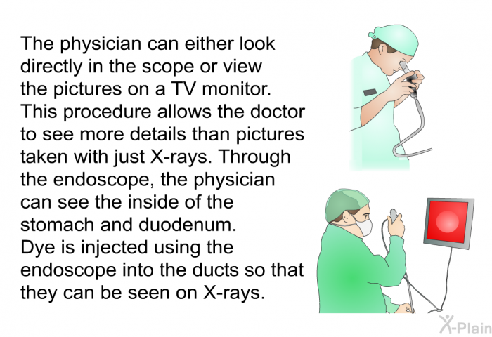 The physician can either look directly in the scope or view the pictures on a TV monitor. This procedure allows the doctor to see more details than pictures taken with just X-rays. Through the endoscope, the physician can see the inside of the stomach and duodenum. Dye is injected using the endoscope into the ducts so that they can be seen on X-rays.