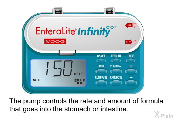 The pump controls the rate and amount of formula that goes into the stomach or intestine.
