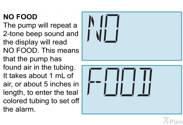 <B>NO FOOD</B> 
The pump will repeat a 2-tone beep sound and the display will read NO FOOD. This means that the pump has found air in the tubing. It takes about 1 mL of air, or about 5 inches in length, to enter the teal colored tubing to set off the alarm.