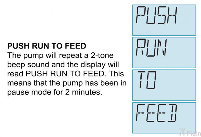 <B>PUSH RUN TO FEED</B>
 The pump will repeat a 2-tone beep sound and the display will read PUSH RUN TO FEED. This means that the pump has been in pause mode for 2 minutes.