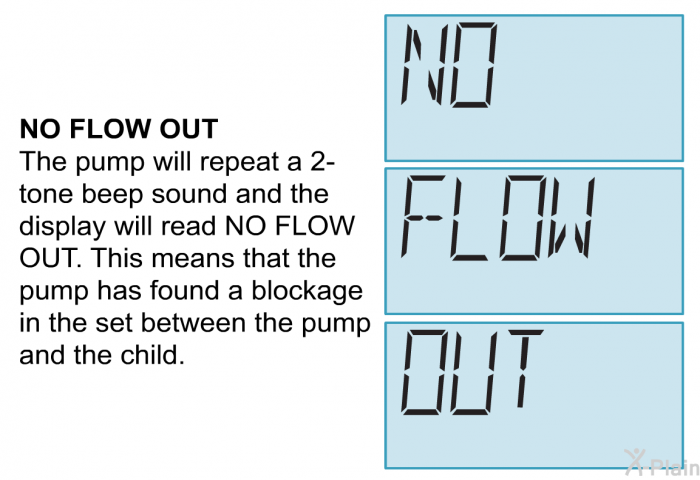 <B>NO FLOW OUT</B>
 The pump will repeat a 2-tone beep sound and the display will read NO FLOW OUT. This means that the pump has found a blockage in the set between the pump and the child.