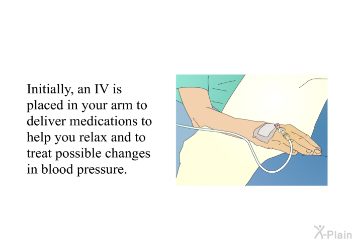 Initially, an IV is placed in your arm to deliver medications to help you relax and to treat possible changes in blood pressure.