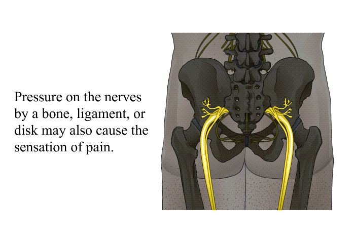 Pressure on the nerves by a bone, ligament, or disk may also cause the sensation of pain.