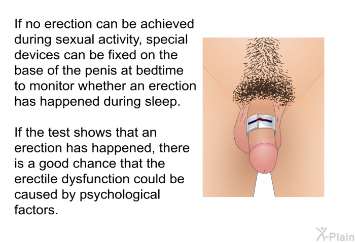 If no erection can be achieved during sexual activity, special devices can be fixed on the base of the penis at bedtime to monitor whether an erection has happened during sleep. If the test shows that an erection has happened, there is a good chance that the erectile dysfunction could be caused by psychological factors.