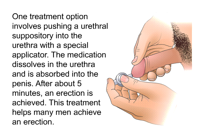 One treatment option involves pushing a urethral suppository into the urethra with a special applicator. The medication dissolves in the urethra and is absorbed into the penis. After about 5 minutes, an erection is achieved. This treatment helps many men achieve an erection.
