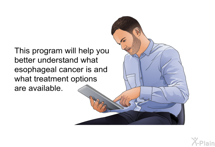 This health information will help you better understand what esophageal cancer is and what treatment options are available.