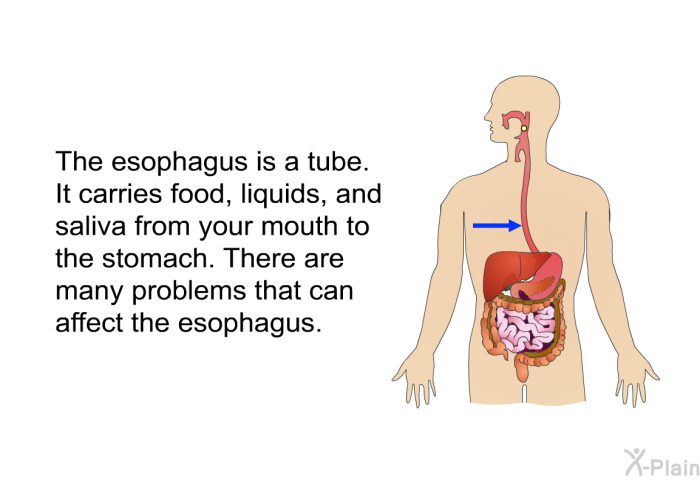 The esophagus is a tube. It carries food, liquids, and saliva from your mouth to the stomach. There are many problems that can affect the esophagus.