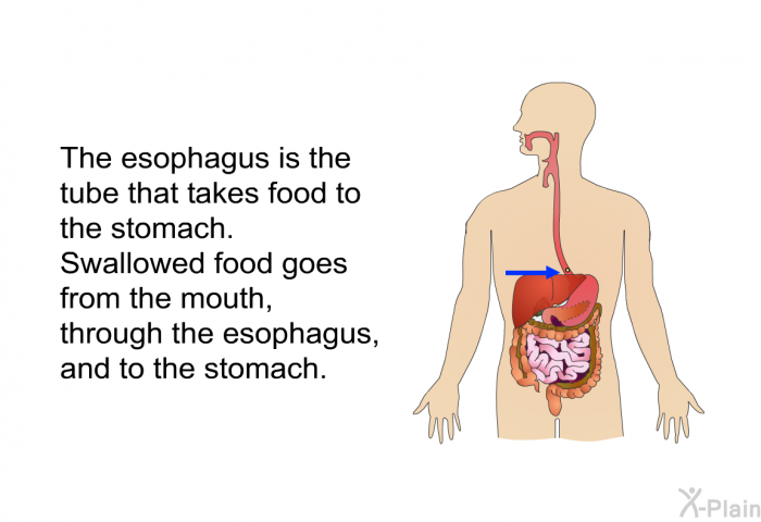The esophagus is the tube that takes food to the stomach. Swallowed food goes from the mouth, through the esophagus, and to the stomach.