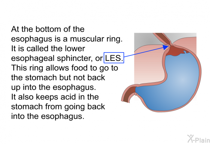 At the bottom of the esophagus is a muscular ring. It is called the lower esophageal sphincter, or LES. This ring allows food to go to the stomach but not back up into the esophagus. It also keeps acid in the stomach from going back into the esophagus.