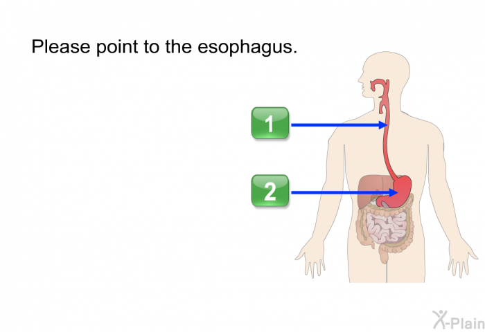 Please point to the esophagus.