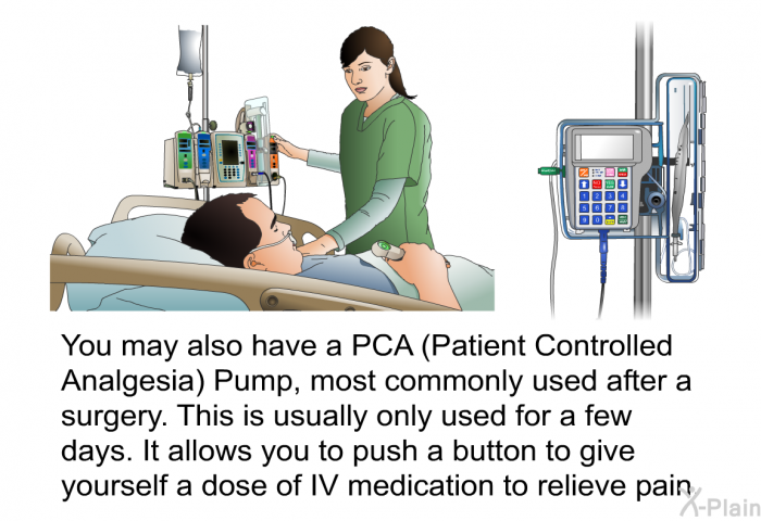 You may also have a PCA (Patient Controlled Analgesia) Pump, most commonly used after a surgery. This is usually only used for a few days. It allows you to push a button to give yourself a dose of IV medication to relieve pain.