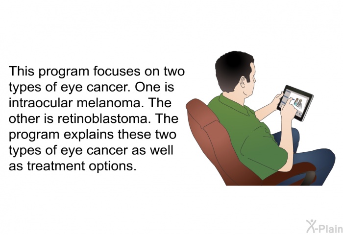 This health information focuses on two types of eye cancer. One is intraocular melanoma. The other is retinoblastoma. The health information explains these two types of eye cancer as well as treatment options.