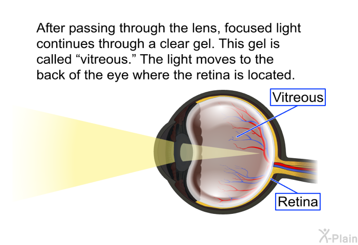 After passing through the lens, focused light continues through a clear gel. This gel is called “vitreous.” The light moves to the back of the eye where the retina is located.