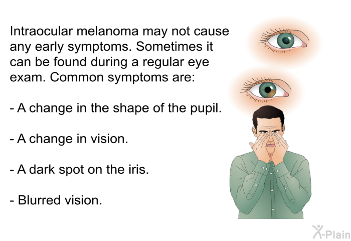 Intraocular melanoma may not cause any early symptoms. Sometimes it can be found during a regular eye exam. Common symptoms are:  A change in the shape of the pupil. A change in vision. A dark spot on the iris. Blurred vision.