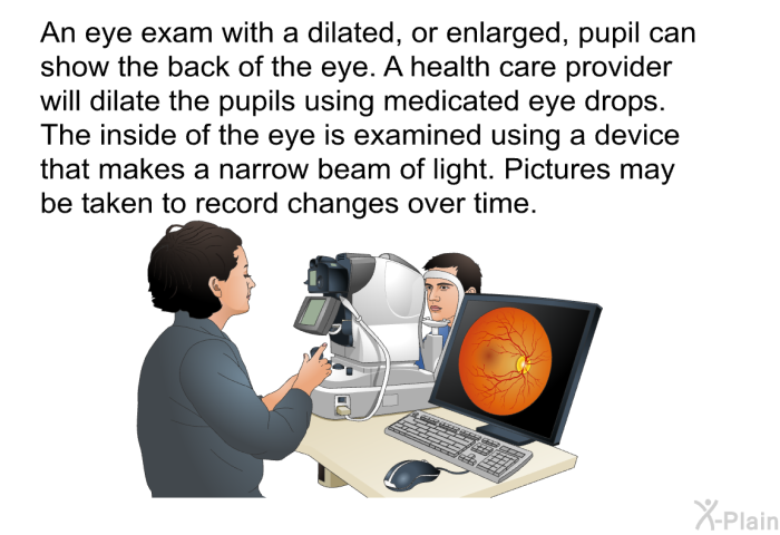 An eye exam with a dilated, or enlarged, pupil can show the back of the eye. A health care provider will dilate the pupils using medicated eye drops. The inside of the eye is examined using a device that makes a narrow beam of light. Pictures may be taken to record changes over time.