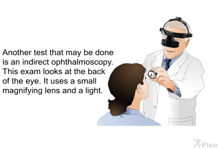 Another test that may be done is an indirect ophthalmoscopy. This exam looks at the back of the eye. It uses a small magnifying lens and a light.