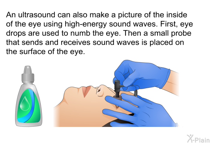 An ultrasound can also make a picture of the inside of the eye using high-energy sound waves. First, eye drops are used to numb the eye. Then a small probe that sends and receives sound waves is placed on the surface of the eye.