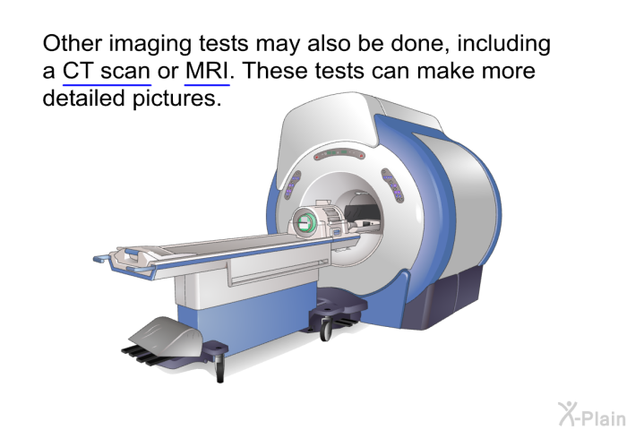 Other imaging tests may also be done, including a CT scan or MRI. These tests can make more detailed pictures.