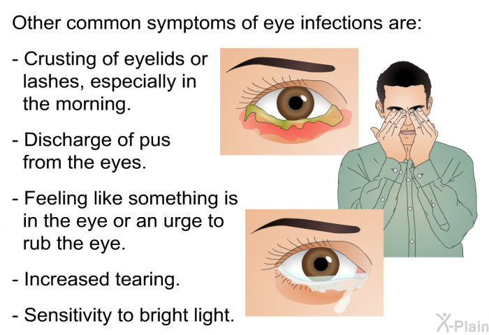 Other common symptoms of eye infections are:  Crusting of eyelids or lashes, especially in the morning. Discharge of pus from the eyes. Feeling like something is in the eye or an urge to rub the eye. Increased tearing. Sensitivity to bright light.