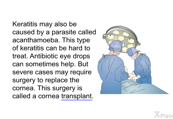 Keratitis may also be caused by a parasite called acanthamoeba. This type of keratitis can be hard to treat. Antibiotic eye drops can sometimes help. But severe cases may require surgery to replace the cornea. This surgery is called a cornea transplant.
