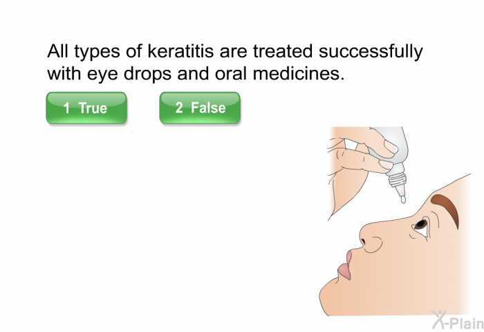 All types of keratitis are treated successfully with eye drops and oral medicines. Select True or False.