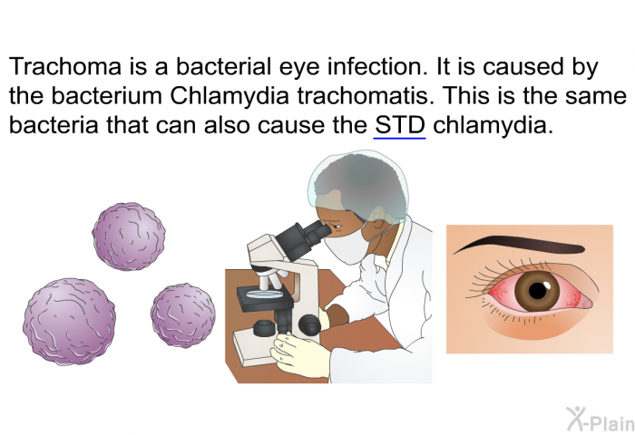 Trachoma is a bacterial eye infection. It is caused by the bacterium Chlamydia trachomatis. This is the same bacteria that can also cause the STD chlamydia.