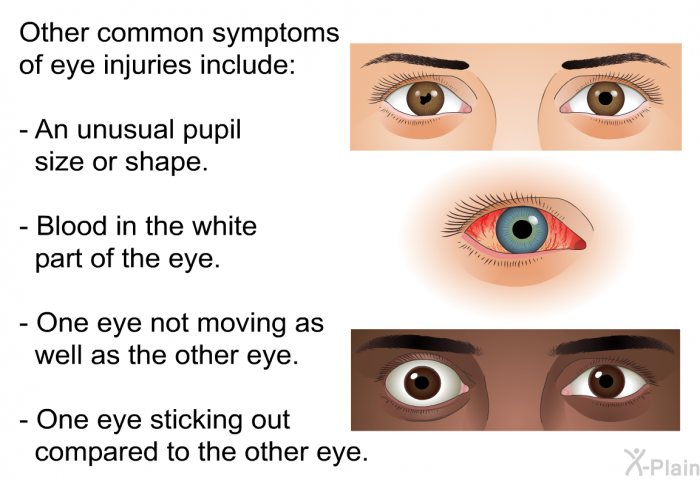 Other common symptoms of eye injuries include:  An unusual pupil size or shape. Blood in the white part of the eye. One eye not moving as well as the other eye. One eye sticking out compared to the other eye.