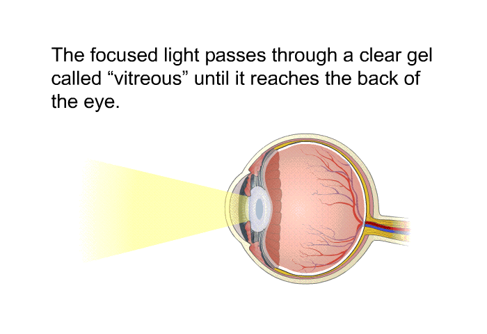 The focused light passes through a clear gel called <I>vitreous</I> until it reaches the back of the eye.