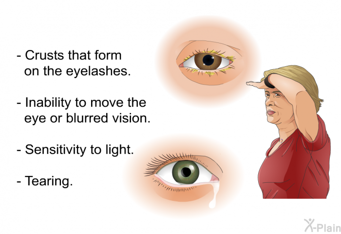 Crusts that form on the eyelashes. Inability to move the eye or blurred vision. Sensitivity to light. Tearing.