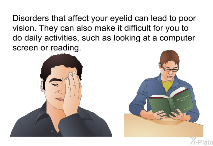 Disorders that affect your eyelid can lead to poor vision. They can also make it difficult for you to do daily activities, such as looking at a computer screen or reading.