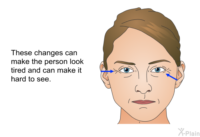 These changes can make the person look tired and can make it hard to see.