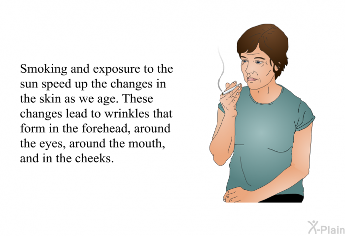 Smoking and exposure to the sun speed up the changes in the skin as we age. These changes lead to wrinkles that form in the forehead, around the eyes, around the mouth, and in the cheeks.