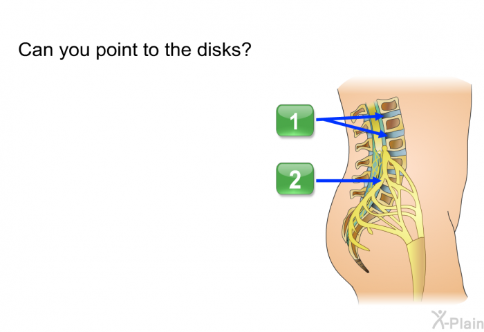 Can you point to the disks? (1/2)