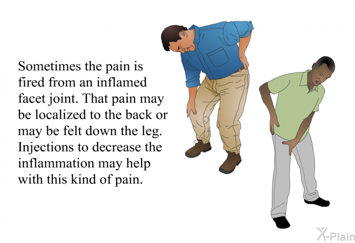 Sometimes the pain is fired from an inflamed facet joint. That pain may be localized to the back or may be felt down the leg. Injections to decrease the inflammation may help with this kind of pain.