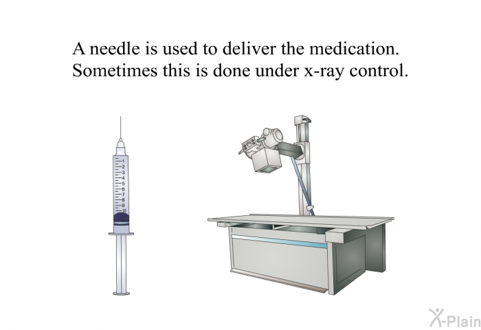 A needle is used to deliver the medication. Sometimes this is done under x-ray control.