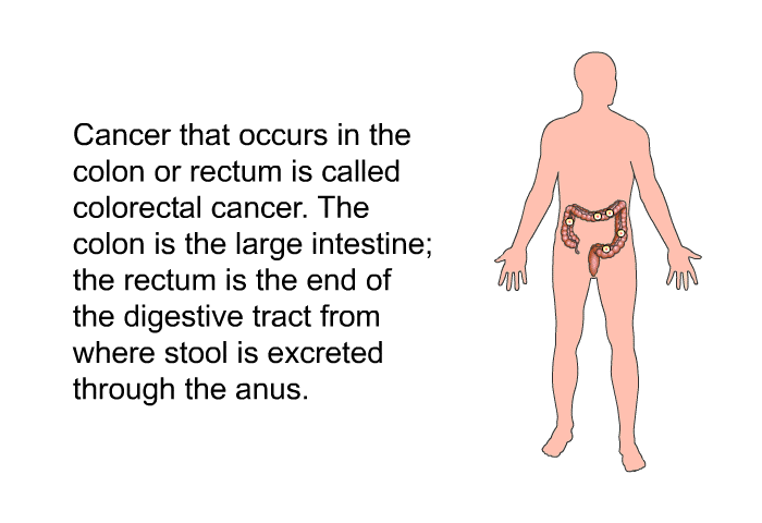 Cancer that occurs in the colon or rectum is called colorectal cancer. The colon is the large intestine; the rectum is the end of the digestive tract from where stool is excreted through the anus.