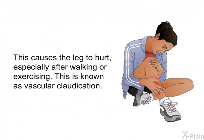 This causes the leg to hurt, especially after walking or exercising. This is known as vascular claudication.