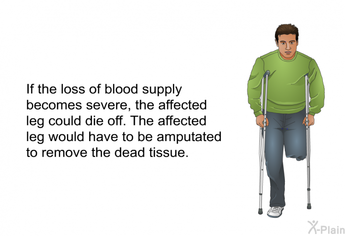 If the loss of blood supply becomes severe, the affected leg could die off. The affected leg would have to be amputated to remove the dead tissue.