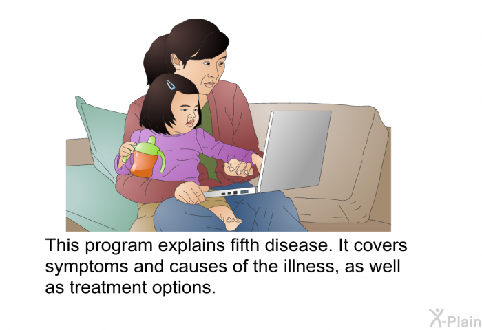 This health information explains fifth disease. It covers symptoms and causes of the illness, as well as treatment options.
