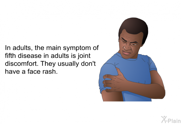 In adults, the main symptom of fifth disease in adults is joint discomfort. They usually don't have a face rash.