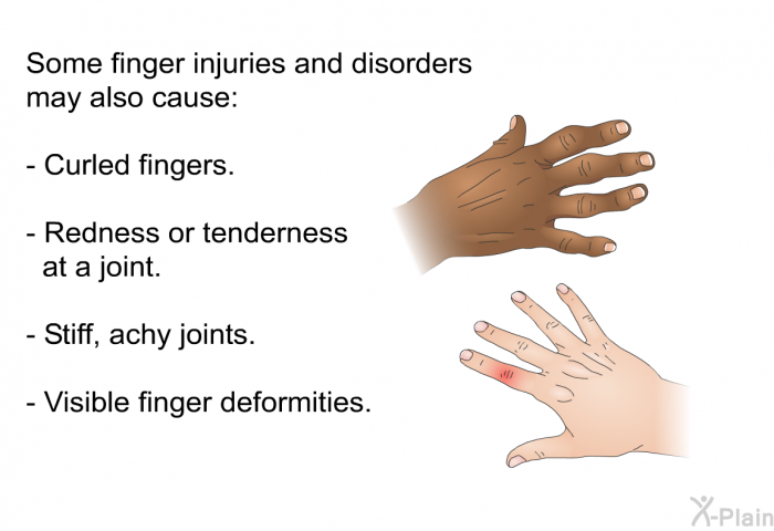 Some finger injuries and disorders may also cause:  Curled fingers. Redness or tenderness at a joint. Stiff, achy joints. Visible finger deformities.