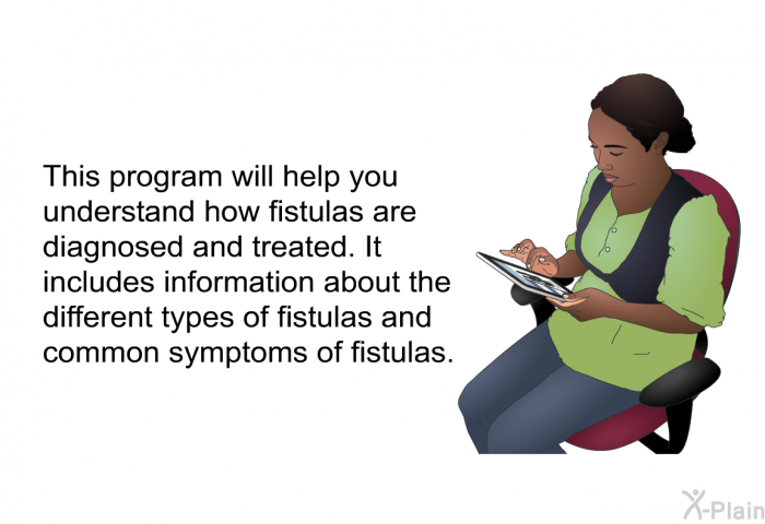 This health information will help you understand how fistulas are diagnosed and treated. It includes information about the different types of fistulas and common symptoms of fistulas.