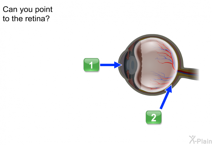 Can you point to the retina?