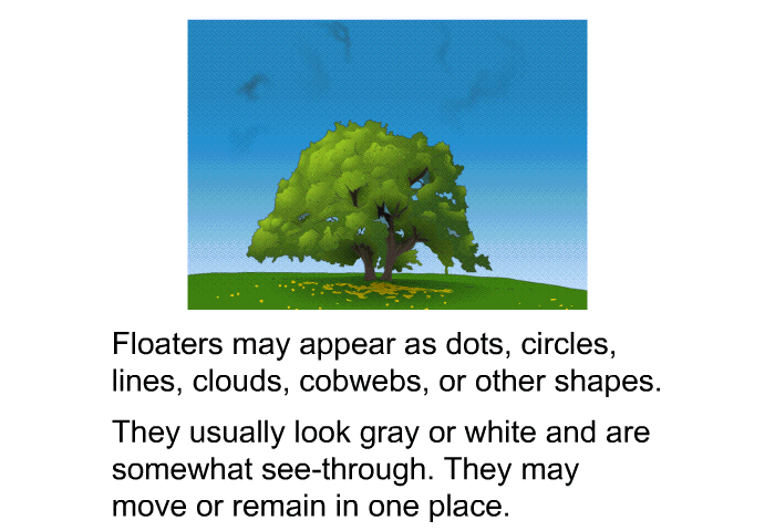 Floaters may appear as dots, circles, lines, clouds, cobwebs, or other shapes. They usually look gray or white and are somewhat see-through. They may move or remain in one place.