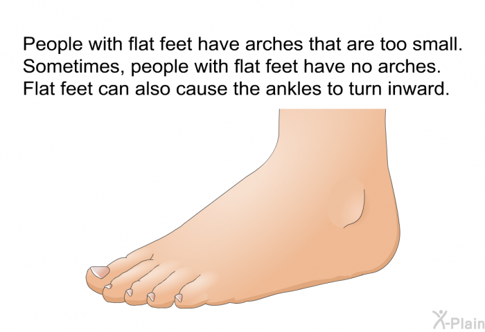 People with flat feet have arches that are too small. Sometimes, people with flat feet have no arches. Flat feet can also cause the ankles to turn inward.