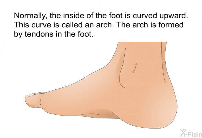 Normally, the inside of the foot is curved upward. This curve is called an arch. The arch is formed by tendons in the foot.