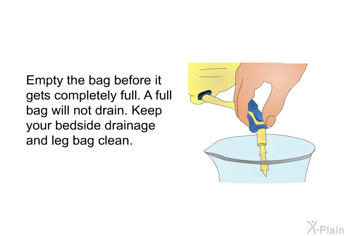 Empty the bag before it gets completely full. A full bag will not drain. Keep your bedside drainage and leg bag clean.