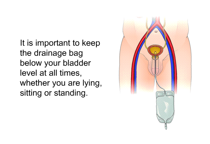 It is important to keep the drainage bag below your bladder level at all times, whether you are lying, sitting or standing.