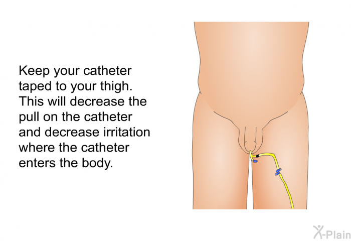 Keep your catheter taped to your thigh. This will decrease the pull on the catheter and decrease irritation where the catheter enters the body.