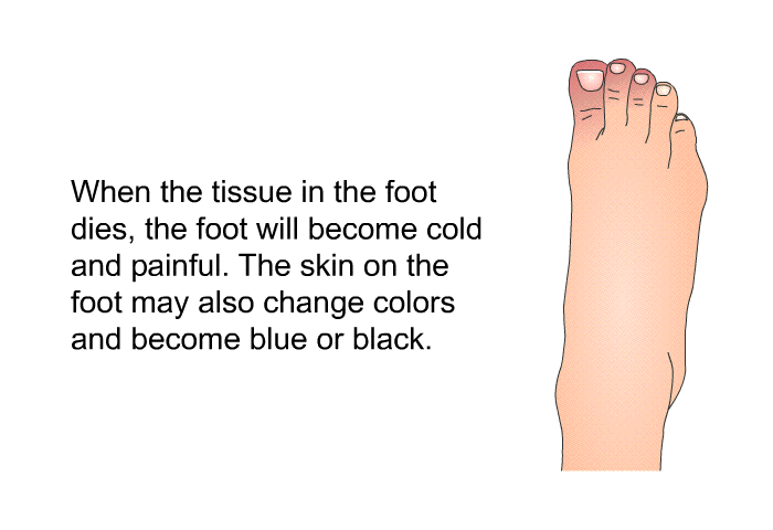 When the tissue in the foot dies, the foot will become cold and painful. The skin on the foot may also change colors and become blue or black.